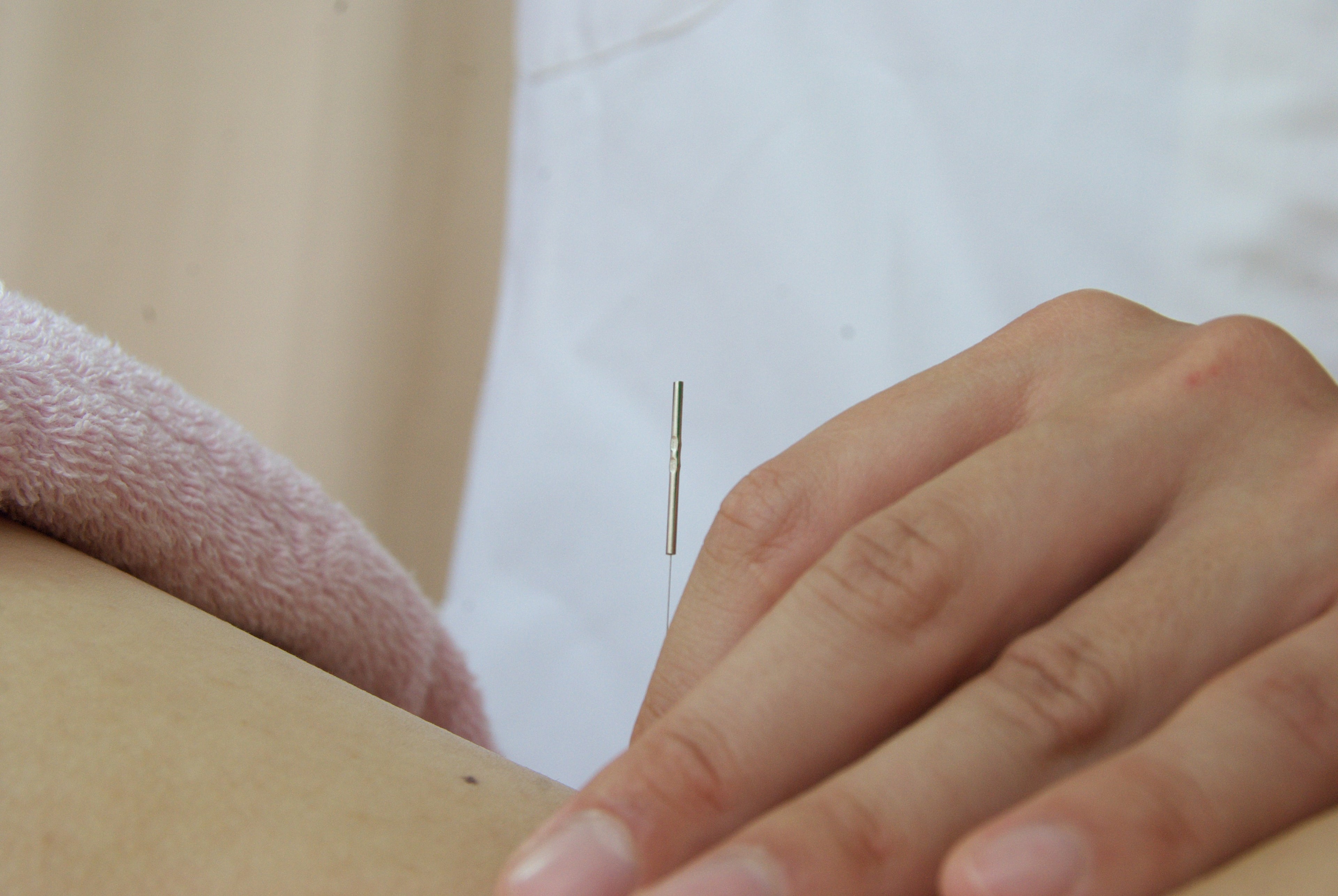 NEOディスポ鍼 ワンタッチ